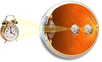 Ako sa vysporiadať s Myopia?