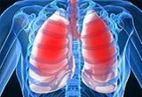 A little about the respiratory distress syndrome of adults