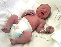 Apnea in newborns