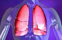 Lungebetændelse, behandling
