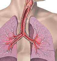 L'asthme bronchique surmontera