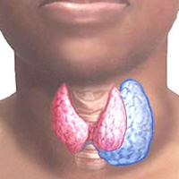 Clinica și diagnosticarea goiului nodal