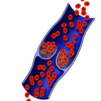 Tromboflebit yüzeysel ve derin damarlar
