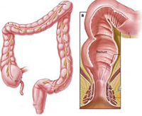 The main symptoms of the fistula rectum