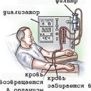 how to conduct hemodialysis