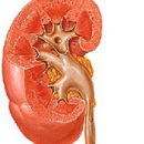 pyelonephritis kidney disease
