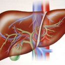 the syndrome of acute liver failure