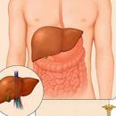 do not lead to cirrhosis of the liver