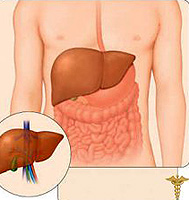Do not bring the liver to cirrhosis