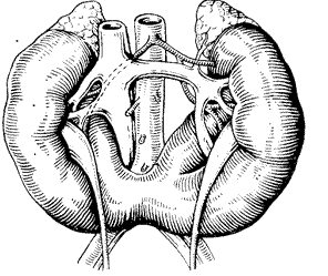 Abnormality v umístění a tvaru ledvin