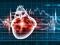 Treatment of atrial fibrillation independently remove the attack