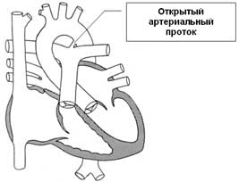 Congenital heart defects: open arterial duct, intersdest and interventricular partition defects