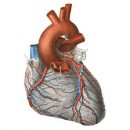 cardiac ischemia