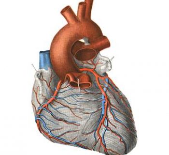 cardiac ischemia
