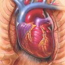 heart attack survival guide