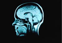 Sintomi e diagnosi di anomalie cerebrali