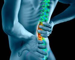you need to know about spinal arachnoiditis