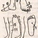 acupressure with vascular dystonia