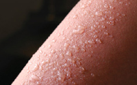 Kožní léze s radiační terapií