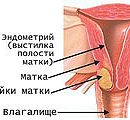 cervical cancer 3