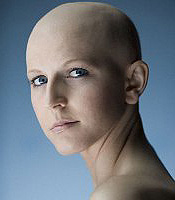 Kemoterapija