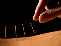 Punctele de acupunctură Capka sunt utilizate pentru pierderea în greutate?