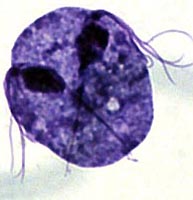 Infection and distribution of trichomaniasis