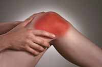 arthritis of the knee