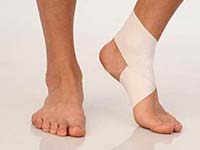 Osteoarthritis of an ankle joint - result of injuries