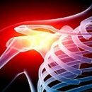 how to treat arthrosis of the shoulder joint