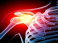 Arthrosis of the Shoulder Treatment Treatment of the disease