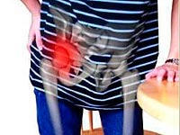 treatment of hip osteoarthritis