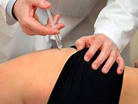 Интраартикуларна ињекција за лечење артрозе зглоба кука