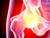 diagnosis of osteoarthritis
