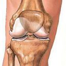 the causes and mechanism of development of osteoarthritis