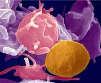 Význam trombocytů a megakaryocytů při trombocytóze