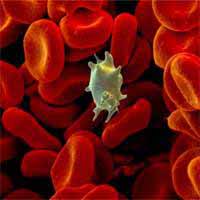 Symptomer på primær trombocytose