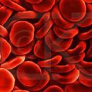 Symptoms and treatment of sickle cell anemia