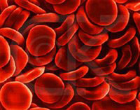 Sintomi e trattamento di anemia falciforme