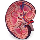 renal amyloidosis is what it is