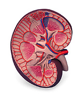 renal amyloidosis is what it is