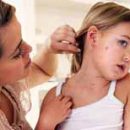 Measles symptoms diagnosis treatment and the importance of prevention