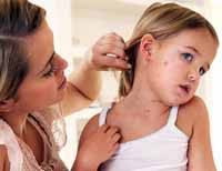 Measles symptoms diagnosis treatment and the importance of prevention
