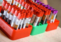 Анализа крви о биохемији