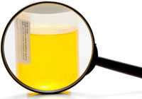 Análise clínica de urina (geral) e indicadores de decodificação