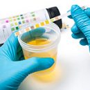 what will tell the chemical composition of urine
