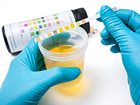 What will tell the chemical composition of urine