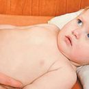 suspected appendicitis in a child that should alert parents