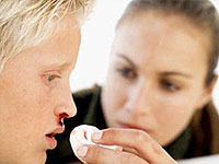 Suspected a nasal fracture in a child - check the symptoms