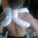 clavicle fracture in children